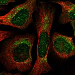 Invitrogen THNSL1 Polyclonal Antibody 100 &mu;L; Unconjugated:Antibodies,