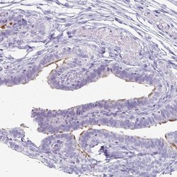 Invitrogen Enkurin Polyclonal Antibody 100 &mu;L; Unconjugated:Antibodies,
