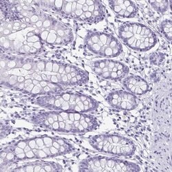 Invitrogen Enkurin Polyclonal Antibody 100 &mu;L; Unconjugated:Antibodies,