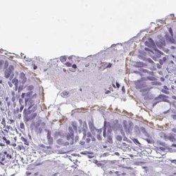 Invitrogen Enkurin Polyclonal Antibody 100 &mu;L; Unconjugated:Antibodies,