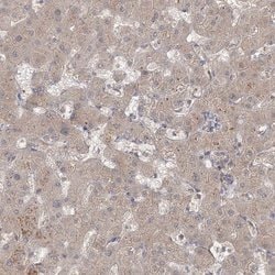 Invitrogen MPP7 Polyclonal Antibody 100 &mu;L; Unconjugated:Antibodies,