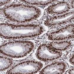 Invitrogen PRPF18 Polyclonal Antibody 100 &mu;L; Unconjugated:Antibodies,