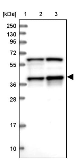 Invitrogen PRPF18 Polyclonal Antibody 100 &mu;L; Unconjugated:Antibodies,