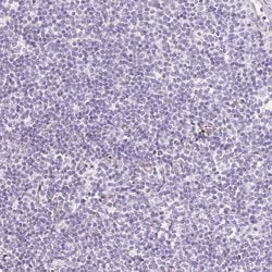 Invitrogen LOXL4 Polyclonal Antibody 100 &mu;L; Unconjugated:Antibodies,