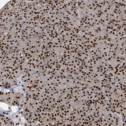 Invitrogen SEPHS1 Polyclonal Antibody 100 &mu;L; Unconjugated:Antibodies,