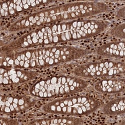 Invitrogen C10orf32 Polyclonal Antibody 100 &mu;L; Unconjugated:Antibodies,