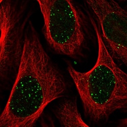 Invitrogen ABRA1 Polyclonal Antibody 100 &mu;L; Unconjugated:Antibodies,