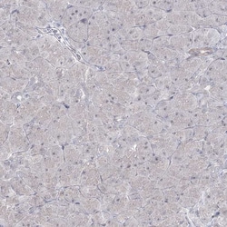 Invitrogen ABRA1 Polyclonal Antibody 100 &mu;L; Unconjugated:Antibodies,