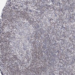 Invitrogen ABRA1 Polyclonal Antibody 100 &mu;L; Unconjugated:Antibodies,