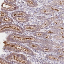 Invitrogen ABHD8 Polyclonal Antibody 100 &mu;L; Unconjugated:Antibodies,