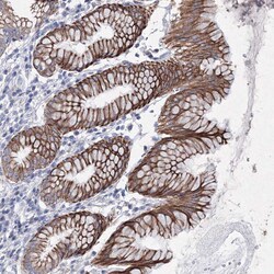 Invitrogen C6orf1 Polyclonal Antibody 100 &mu;L; Unconjugated:Antibodies,