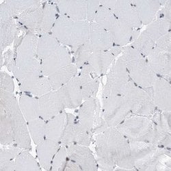 Invitrogen SFRS12 Polyclonal Antibody 100 &mu;L | Buy Online | Invitrogen&trade; | Fisher Scientific