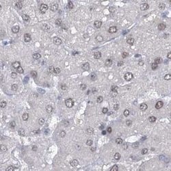 Invitrogen SFRS12 Polyclonal Antibody 100 &mu;L | Buy Online | Invitrogen&trade; | Fisher Scientific