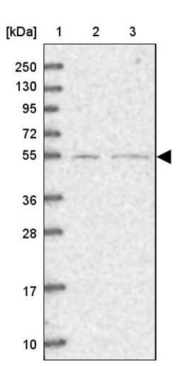 Invitrogen SFRS12 Polyclonal Antibody 100 &mu;L | Buy Online | Invitrogen&trade; | Fisher Scientific