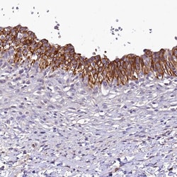 Invitrogen SH3TC2 Polyclonal Antibody 100 &mu;L | Buy Online | Invitrogen&trade; | Fisher Scientific