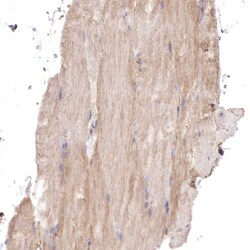 Invitrogen FCHO2 Polyclonal Antibody 100 &mu;L; Unconjugated:Antibodies,