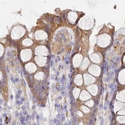 Invitrogen FCHO2 Polyclonal Antibody 100 &mu;L; Unconjugated:Antibodies,