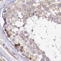 Invitrogen FCHO2 Polyclonal Antibody 100 &mu;L; Unconjugated:Antibodies,