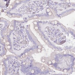 Invitrogen Rbm20 Polyclonal Antibody 100 &mu;L; Unconjugated:Antibodies,