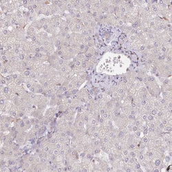 Invitrogen Rbm20 Polyclonal Antibody 100 &mu;L; Unconjugated:Antibodies,