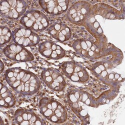Invitrogen LSG1 Polyclonal Antibody 100 &mu;L; Unconjugated:Antibodies,