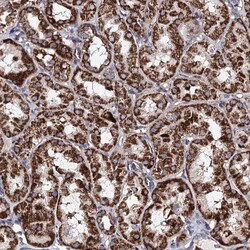 Invitrogen ACAD9 Polyclonal Antibody 100 &mu;L | Buy Online | Invitrogen&trade; | Fisher Scientific