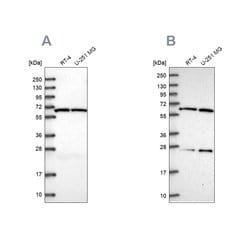 Invitrogen ACAD9 Polyclonal Antibody 100 &mu;L | Buy Online | Invitrogen&trade; | Fisher Scientific