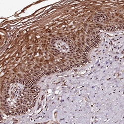 Invitrogen MAML3 Polyclonal Antibody 100 &mu;L; Unconjugated:Antibodies,