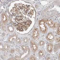 Invitrogen MAT2B Polyclonal Antibody 100 &mu;L; Unconjugated:Antibodies,