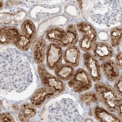 Invitrogen MAT2B Polyclonal Antibody 100 &mu;L; Unconjugated:Antibodies,