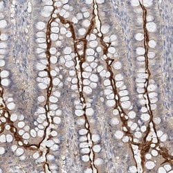 Invitrogen MAT2B Polyclonal Antibody 100 &mu;L; Unconjugated:Antibodies,