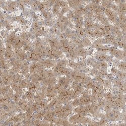 Invitrogen MAT2B Polyclonal Antibody 100 &mu;L; Unconjugated:Antibodies,
