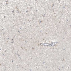 Invitrogen MAT2B Polyclonal Antibody 100 &mu;L; Unconjugated:Antibodies,