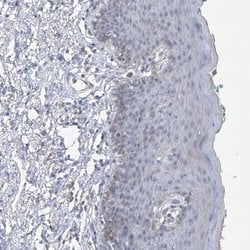 Invitrogen MAT2B Polyclonal Antibody 100 &mu;L; Unconjugated:Antibodies,