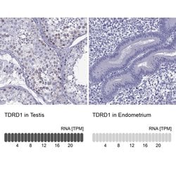 Invitrogen TDRD1 Polyclonal Antibody 100 &mu;L; Unconjugated:Antibodies,