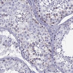 Invitrogen TDRD1 Polyclonal Antibody 100 &mu;L; Unconjugated:Antibodies,