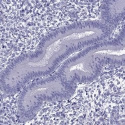 Invitrogen TDRD1 Polyclonal Antibody 100 &mu;L; Unconjugated:Antibodies,