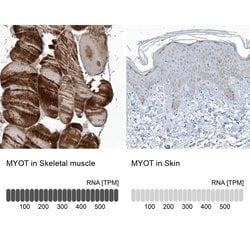 Invitrogen Myotilin Polyclonal Antibody 100 &mu;L; Unconjugated:Antibodies,