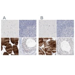 Invitrogen Myotilin Polyclonal Antibody 100 &mu;L; Unconjugated:Antibodies,