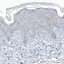 Invitrogen Myotilin Polyclonal Antibody 100 &mu;L; Unconjugated:Antibodies,