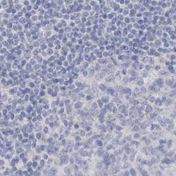Invitrogen Myotilin Polyclonal Antibody 100 &mu;L; Unconjugated:Antibodies,