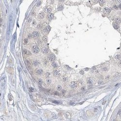 Invitrogen Myotilin Polyclonal Antibody 100 &mu;L; Unconjugated:Antibodies,