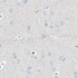 Invitrogen Myotilin Polyclonal Antibody 100 &mu;L; Unconjugated:Antibodies,