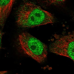 Invitrogen HECTD2 Polyclonal Antibody 100 &mu;L; Unconjugated:Antibodies,