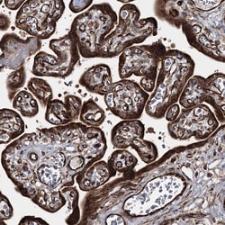 Invitrogen HECTD2 Polyclonal Antibody 100 &mu;L; Unconjugated:Antibodies,