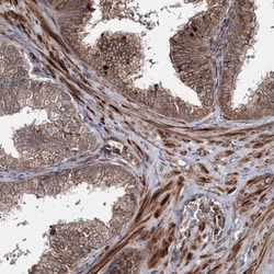 Invitrogen HECTD2 Polyclonal Antibody 100 &mu;L; Unconjugated:Antibodies,