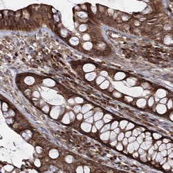 Invitrogen HECTD2 Polyclonal Antibody 100 &mu;L; Unconjugated:Antibodies,