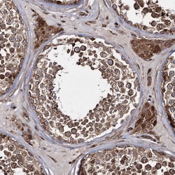 Invitrogen HECTD2 Polyclonal Antibody 100 &mu;L; Unconjugated:Antibodies,