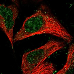 Invitrogen TRAPPC13 Polyclonal Antibody 100 &mu;L; Unconjugated:Antibodies,