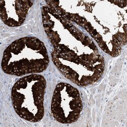 Invitrogen TRAPPC13 Polyclonal Antibody 100 &mu;L; Unconjugated:Antibodies,